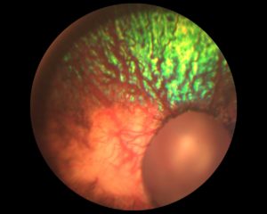 Kolobom, Mira DSH-Mix O.d . G. Steinbach